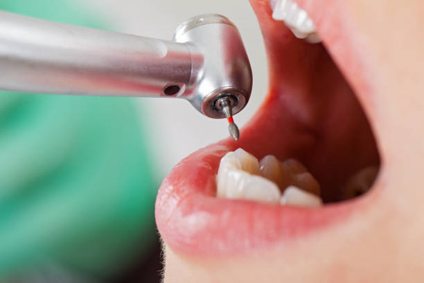 Best Emergency Dental Services for Seniors in Wilson, PA